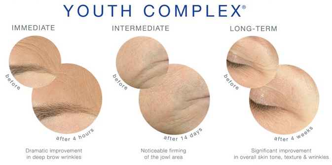 iS Clinical Youth Complex Immediate Results, Longer Term Results for Wrinkles, Fine Lines